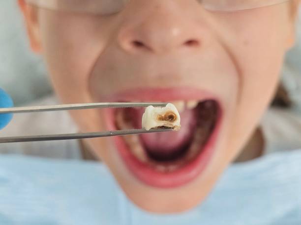 Best Same-Day Emergency Dentist in Glendale, MS